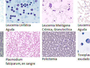 Hematología